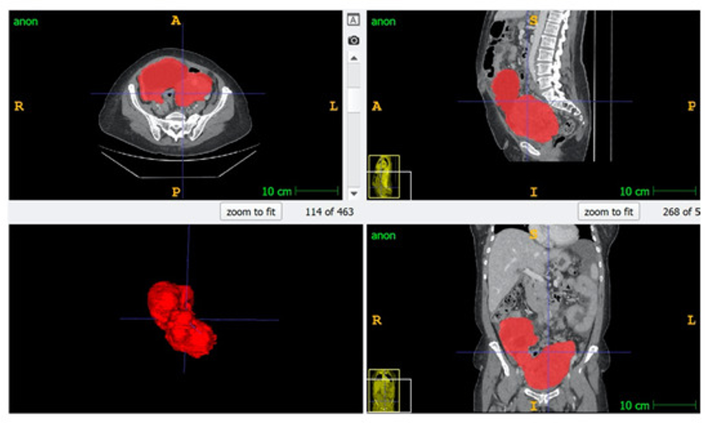 Medical Imaging Example